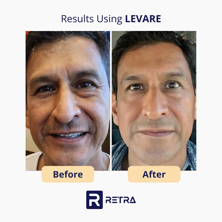 3 Step Facelift skincare reviews