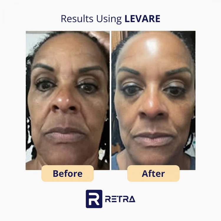 3 Step Facelift skincare reviews