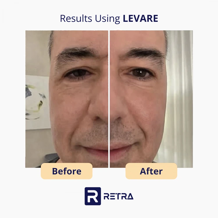 3 Step Facelift skincare reviews