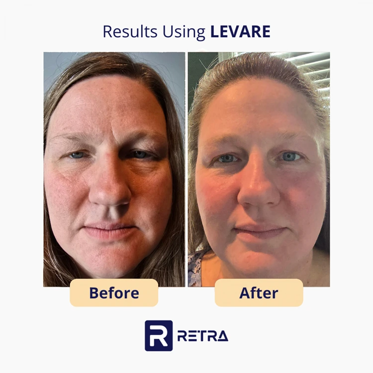 3 Step Facelift skincare reviews