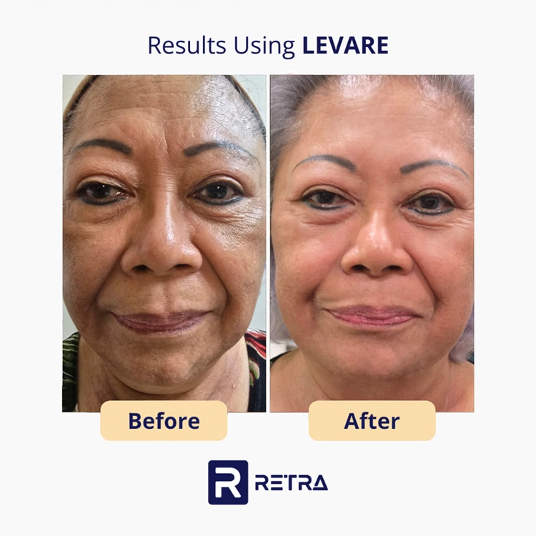 3 Step Facelift skincare reviews