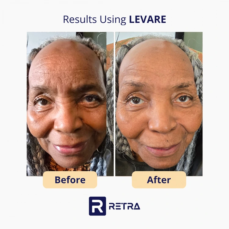 3 Step Facelift skincare reviews