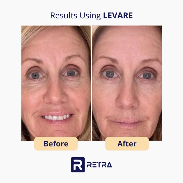 3 Step Facelift skincare reviews