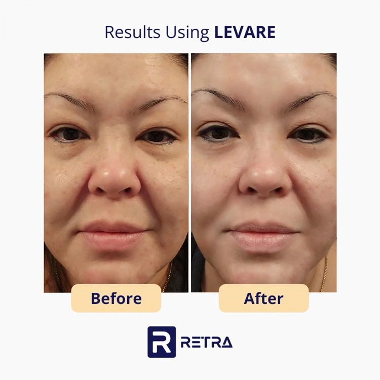 anti-aging skincare reviews