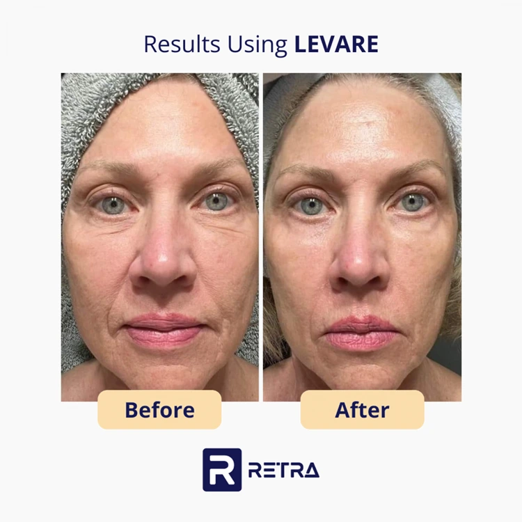 Levare skincare reviews