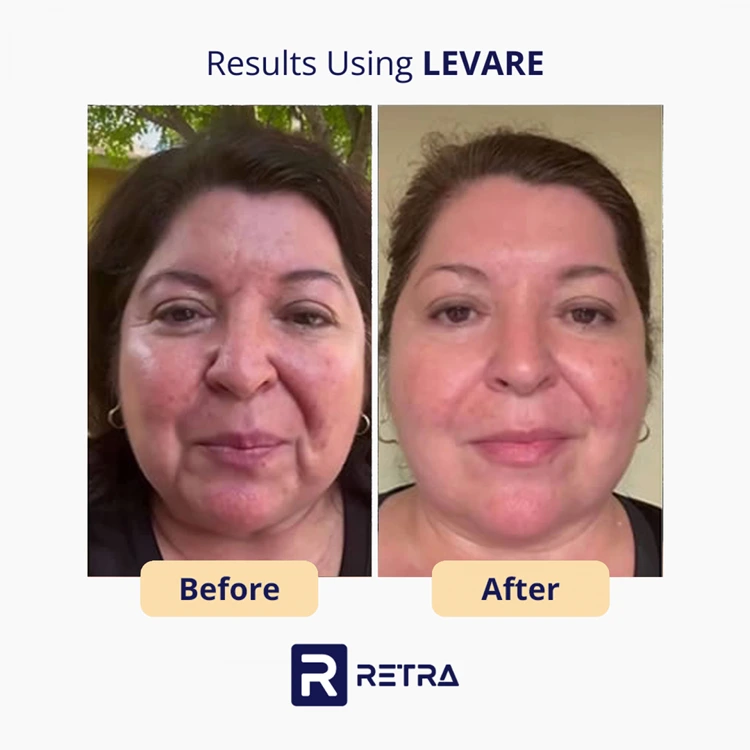 Levare skincare reviews