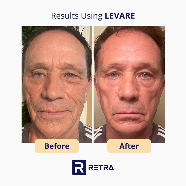 Levare skincare reviews