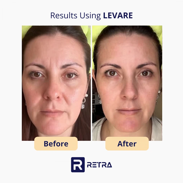 3 Step Facelift skincare reviews