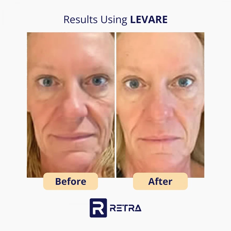 3 Step Facelift skincare reviews