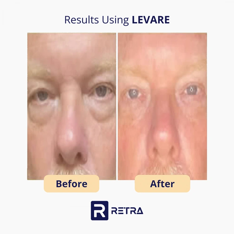 3 Step Facelift skincare reviews