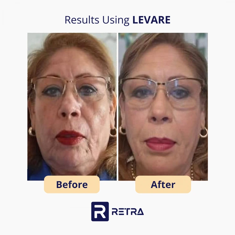 3 Step Facelift skincare reviews