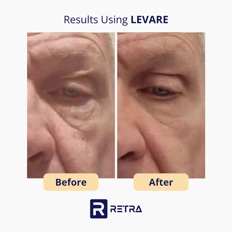 3 Step Facelift skincare reviews